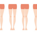 気になるO脚の改善方法