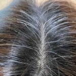 白髪予防対策におすすめの方法